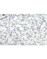 IHC easy ® CSTF3 Ready-To-Use IHC Kit KHC1698 proteintech