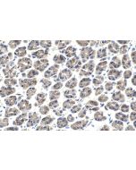 IHC easy ® BECN1 Ready-To-Use IHC Kit KHC1731 proteintech