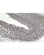 IHC easy ® CHD4 Ready-To-Use IHC Kit KHC1737 proteintech