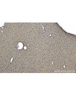 IHC easy ® MTF1 Ready-To-Use IHC Kit KHC1738 proteintech