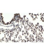 IHC easy ® JMJD6 Ready-To-Use IHC Kit KHC1788 proteintech