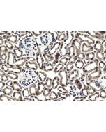 IHC easy ® KMT2E/MLL5 Ready-To-Use IHC Kit KHC1827 proteintech