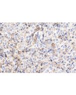 IHC easy ® FBXW7 Ready-To-Use IHC Kit KHC1872 proteintech