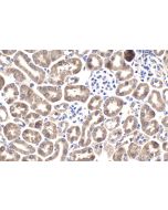 IHC easy ® NOX4 Ready-To-Use IHC Kit KHC1954 proteintech