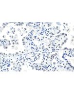 IHC easy ® SLTM Ready-To-Use IHC Kit KHC1967 proteintech