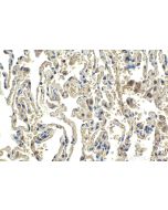 IHC easy ® FBXW11 Ready-To-Use IHC Kit KHC1989 proteintech
