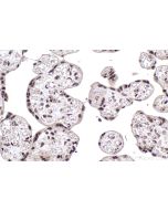 IHC easy ® GMEB2 Ready-To-Use IHC Kit KHC1990 proteintech