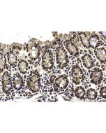 IHC easy ® SUPT16H Ready-To-Use IHC Kit KHC2026 proteintech