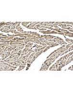 IHC easy ® PSMD14 Ready-To-Use IHC Kit KHC2047 proteintech
