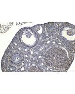 IHC easy ® RCAS1 Ready-To-Use IHC Kit KHC2050 proteintech