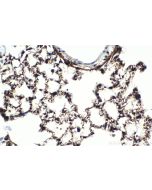 IHC easy ® SEPT4 Ready-To-Use IHC Kit KHC2073 proteintech