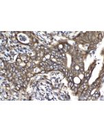 IHC easy ® FAM62B Ready-To-Use IHC Kit KHC2082 proteintech