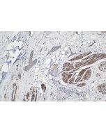 IHC easy ® SRGAP2 Ready-To-Use IHC Kit KHC2105 proteintech