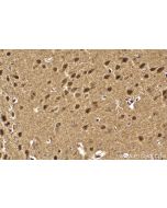 IHC easy ® MYCBP2 Ready-To-Use IHC Kit KHC2116 proteintech