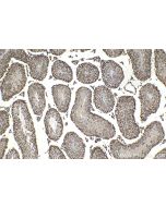 IHC easy ® PIAS1 Ready-To-Use IHC Kit KHC2122 proteintech