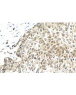 IHC easy ® RECQL5 Ready-To-Use IHC Kit KHC2128 proteintech