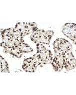 IHC easy ® POLR3D Ready-To-Use IHC Kit KHC2161 proteintech