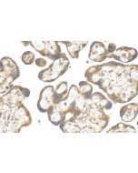 IHC easy ® YES1 Ready-To-Use IHC Kit KHC2166 proteintech