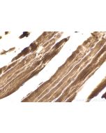 IHC easy ® ANK1 Ready-To-Use IHC Kit KHC2191 proteintech