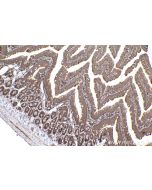 IHC easy ® OSBP Ready-To-Use IHC Kit KHC2206 proteintech