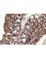 IHC easy ® RRM2 Ready-To-Use IHC Kit KHC2233 proteintech