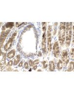 IHC easy ® ABCD1 Ready-To-Use IHC Kit KHC2240 proteintech
