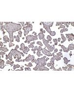 IHC easy ® LIS1 Ready-To-Use IHC Kit KHC2272 proteintech