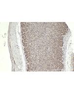 IHC easy ® IRAK1 Ready-To-Use IHC Kit KHC2304 proteintech