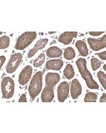 IHC easy ® NEK4 Ready-To-Use IHC Kit KHC2308 proteintech