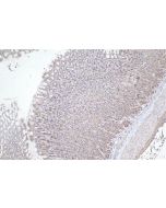 IHC easy ® GPSM2 Ready-To-Use IHC Kit KHC2370 proteintech