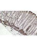 IHC easy ® MYLK Ready-To-Use IHC Kit KHC2496 proteintech