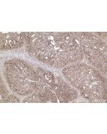 IHC easy ® MAP9 Ready-To-Use IHC Kit KHC2531 proteintech