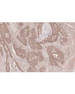 IHC easy ® FAM83B Ready-To-Use IHC Kit KHC2548 proteintech