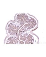 IHC easy ® HECTD3 Ready-To-Use IHC Kit KHC2553 proteintech