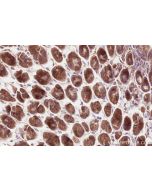 IHC easy ® VPS53 Ready-To-Use IHC Kit KHC2560 proteintech