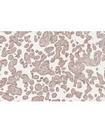 IHC easy ® DAB2IP Ready-To-Use IHC Kit KHC2564 proteintech