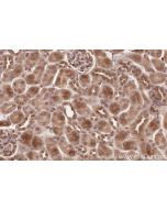 IHC easy ® PHF17 Ready-To-Use IHC Kit KHC2579 proteintech