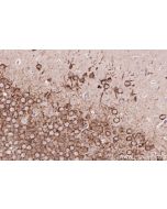 IHC easy ® CCSAP Ready-To-Use IHC Kit KHC2581 proteintech