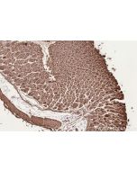 IHC easy ® BORA Ready-To-Use IHC Kit KHC2590 proteintech