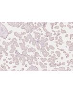 IHC easy ® ARHGEF18 Ready-To-Use IHC Kit KHC2605 proteintech