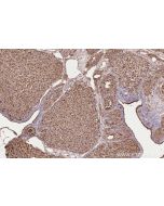 IHC easy ® NPHP3 Ready-To-Use IHC Kit KHC2621 proteintech