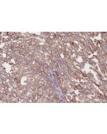 IHC easy ® DCUN1D3 Ready-To-Use IHC Kit KHC2651 proteintech