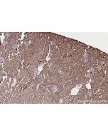 IHC easy ® RDH10 Ready-To-Use IHC Kit KHC2665 proteintech
