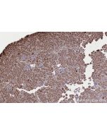 IHC easy ® PAPD5 Ready-To-Use IHC Kit KHC2688 proteintech
