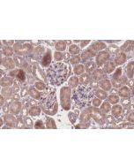 IHC easy ® BRK1/C3orf10 Ready-To-Use IHC Kit KHC2733 proteintech