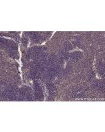 IHC easy ® RAB8 Ready-To-Use IHC Kit KHC2766 proteintech