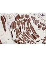IHC easy ® PHKB Ready-To-Use IHC Kit KHC2772 proteintech