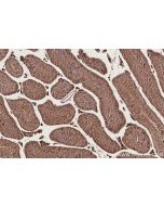 IHC easy ® CCDC99 Ready-To-Use IHC Kit KHC2787 proteintech