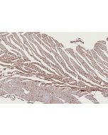 IHC easy ® TRIM11 Ready-To-Use IHC Kit KHC2790 proteintech