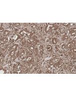 IHC easy ® CNDP2 Ready-To-Use IHC Kit KHC2804 proteintech